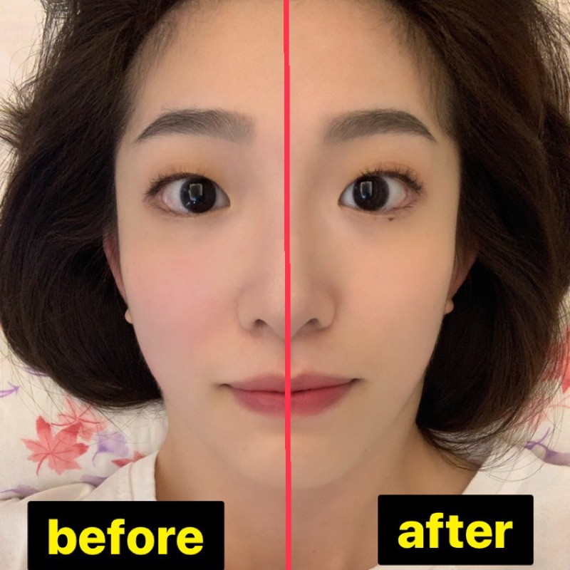 小顏美人美容 小臉 歪斜矯正 臉部按摩 蝦皮購物