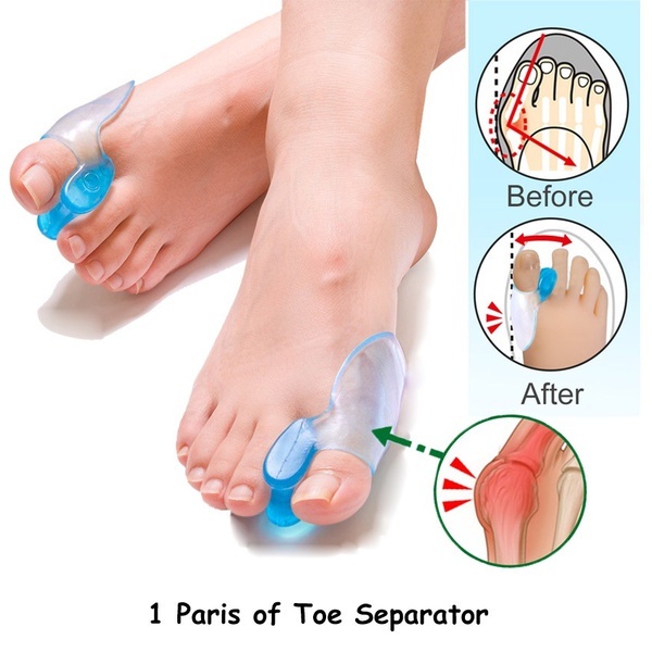 軟矽膠脚趾分離器拇趾外翻拇趾囊炎墊片拇指矯正器足部護理工具
