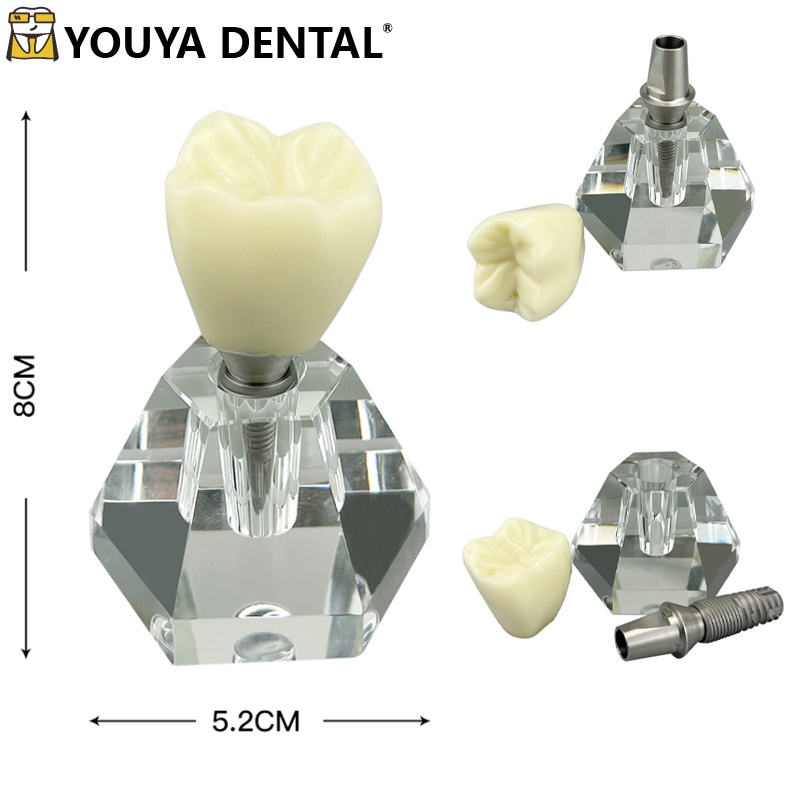 牙醫水晶牙齒植入模型透明牙齒植入練習模型牙醫可拆卸牙齒模型牙科