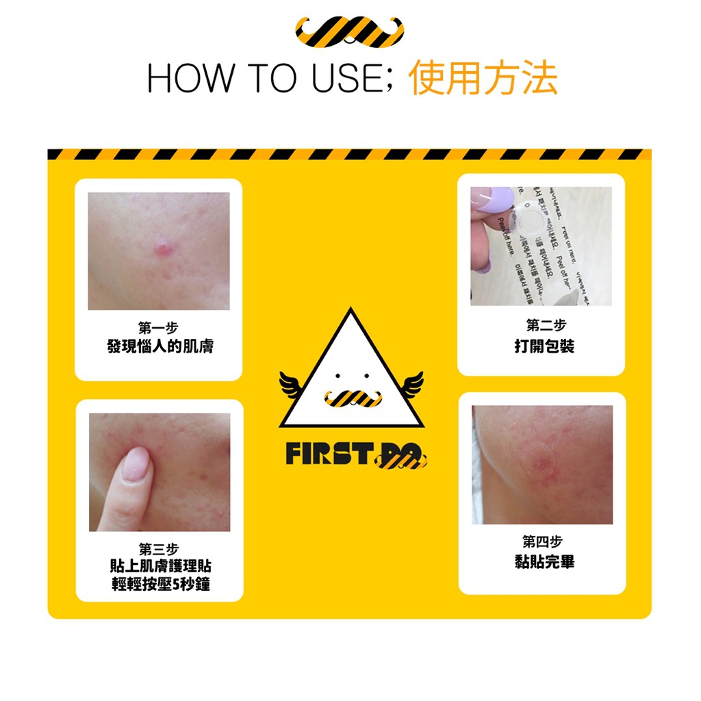 韓國artpe昂普微針肌膚調理貼 另贈調理面膜 蝦皮購物