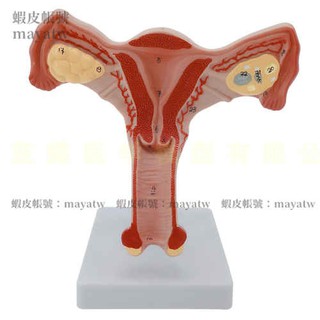 (MD-B_0718)人體女性生殖子宮解剖病理模型 陰道卵巢教學模型 婦科生殖科教具