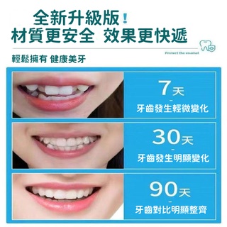 【台灣公司現貨-有發票】牙齒矯正器  9D隱形牙套 學生成人定制糾正器 夜間防磨牙牙套 牙齒調整器 牙不齊 齙牙糾正神器 #6