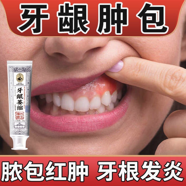Toothpaste / loose teeth 牙齦腫包【藥監備案】修護牙齒鬆動牙齦萎縮牙膏牙根發炎牙齦炎用