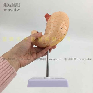 (MD-B_1392)胃 胃模型 胃解剖模型 自然大胃解剖模型 人體胃剖面教學模型