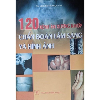 第 120 冊骨關節炎和民用診斷 (TS. Nguyen Thi Ngoc Lan)
