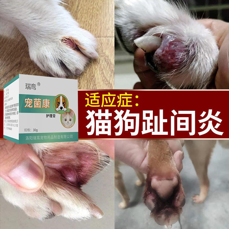 趾間炎 優惠推薦 21年1月 蝦皮購物台灣