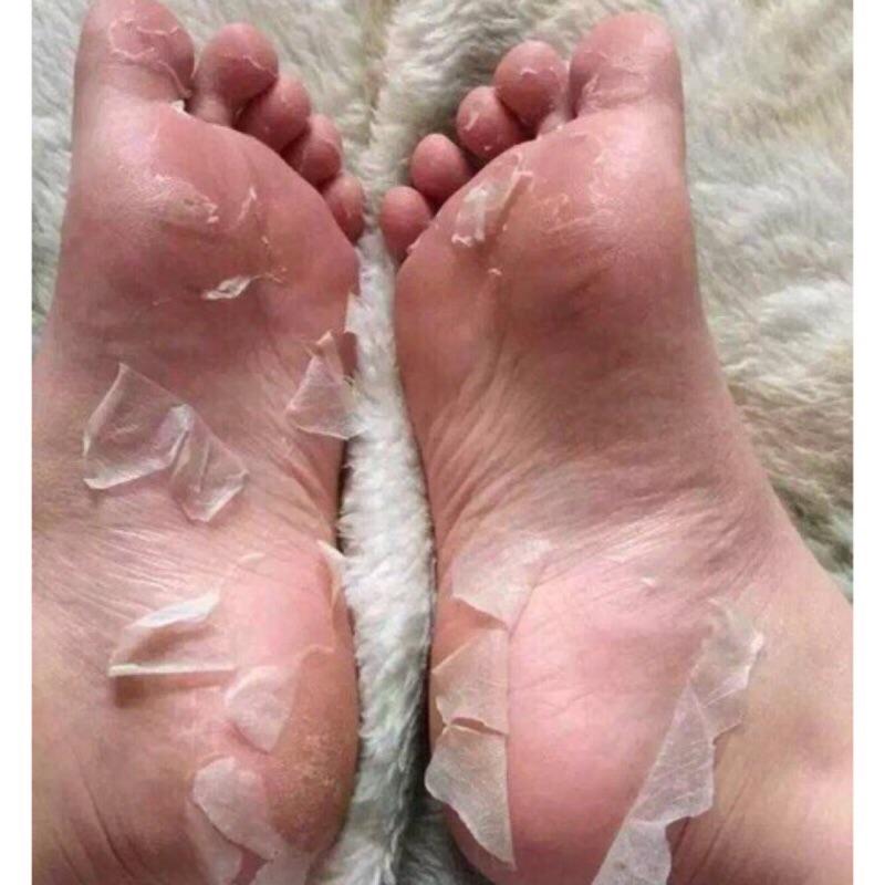 Ashiura Ranrun去腳皮去死皮足膜40分 現貨 蝦皮購物