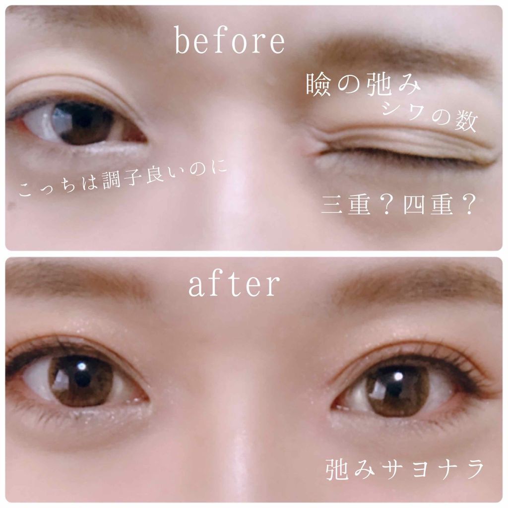 現貨出清 Dup Orishiki 薄膜隱形式雙眼皮膠水雙眼皮膠dup折式雙眼皮膜開發票 蝦皮購物