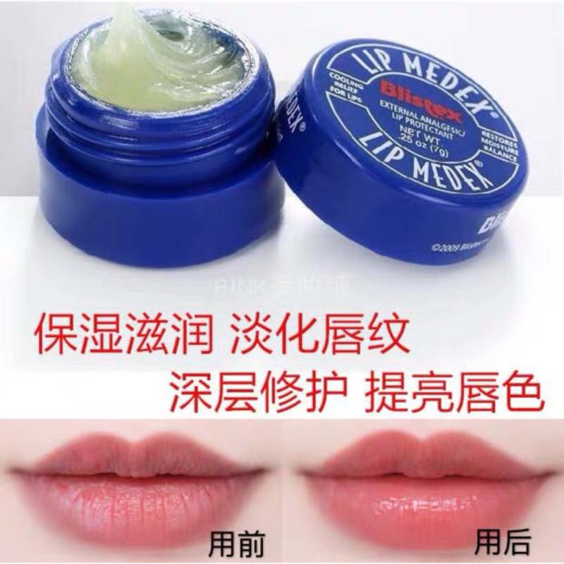 美国最畅销的润唇膏碧唇小蓝罐唇膏