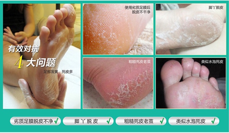 現貨 七天嫩腳脫皮足膜 去角質 蝦皮購物