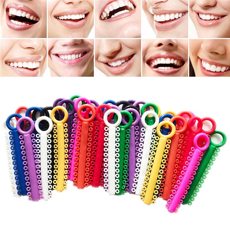 40 條 / 袋牙齒正畸結紮帶彈性橡皮筋牙醫工具可支撐牙齒多色的彈性
