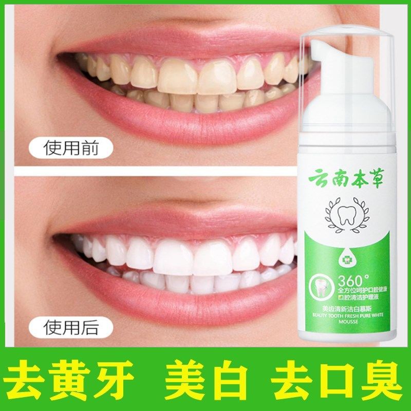 現貨秒發 升級版 慕斯牙膏潔牙神器美白牙齒去黃牙結石口臭洗牙粉祛煙漬 蝦皮購物