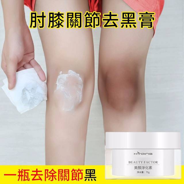 肘膝去黑神器 關節去黑去黑色素手肘胳膊肘去黑肘膝按摩膏清潔 好物購 蝦皮購物
