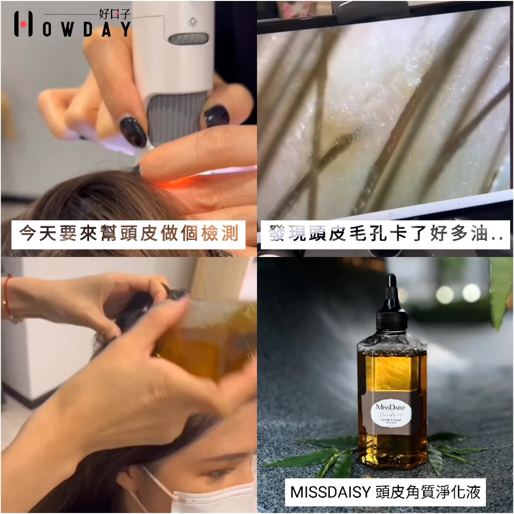 MISSDAISY 頭皮角質平衡淨化液 200mL 頭皮淨化 頭皮清潔 頭皮護理 頭皮屑 頭皮味 頭皮洗髮精