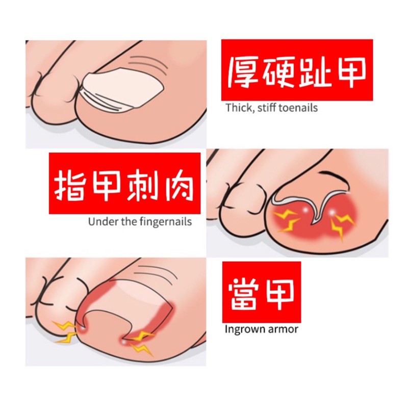 鷹嘴鉗死皮剪死皮當甲剪鉗 美甲神器鷹嘴指甲剪鉗趾甲美容死皮當甲去除甲溝厚趾甲修剪清潔用品指甲剪指甲刀指甲鉗