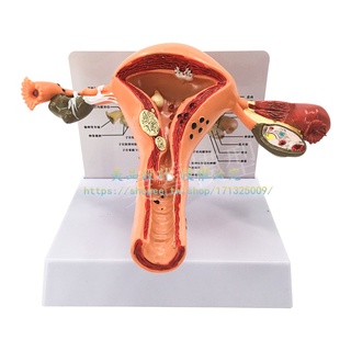 女性生殖模器模型女性生殖模器模型私密子宮模型教具婦科卵巢解剖【美品LDYX】