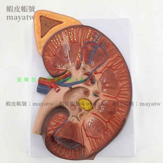 (MD-B_0734)三倍放大 腎臟解剖放大模型 腎臟解剖模型 腎上腺 腎臟結構模型