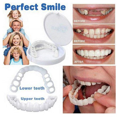 上下牙齒貼面抗真菌牙套 Snap On Smile 牙齒美白假牙舒適貼面覆蓋牙齒