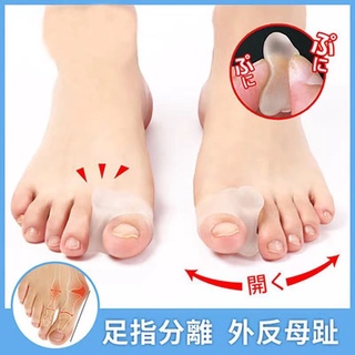 【腳趾矯正器】【拇指外翻】大腳趾拇外翻矯正器兒童分趾器拇指外翻矯正器男女矯正腳趾可穿鞋