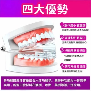 【台灣公司現貨-有發票】牙齒矯正器  9D隱形牙套 學生成人定制糾正器 夜間防磨牙牙套 牙齒調整器 牙不齊 齙牙糾正神器 #5