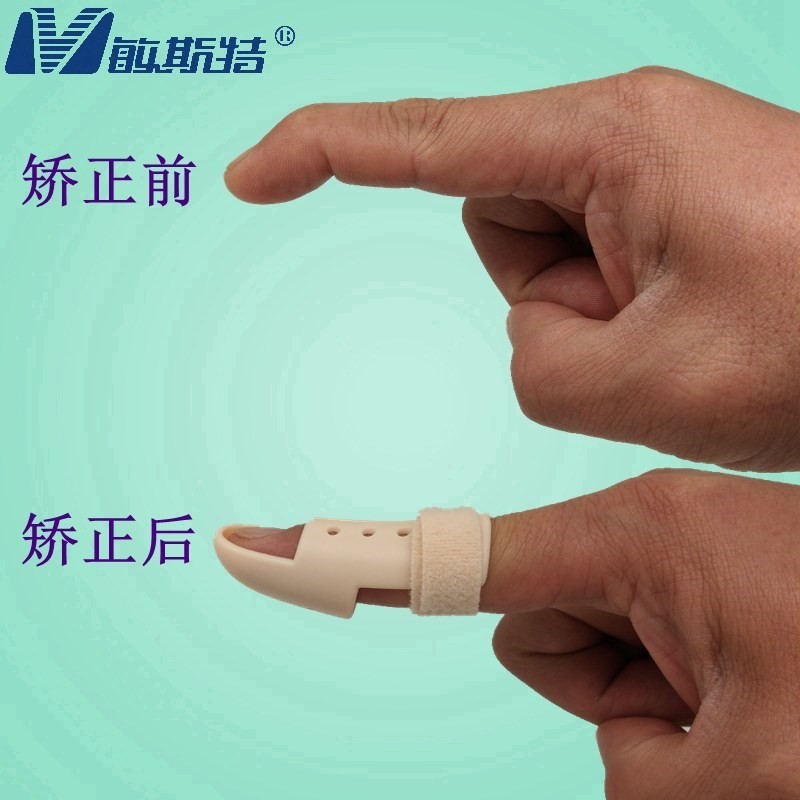 斷裂手指護套小指骨折拇指脫位受傷關節兒童中指糾正肌腱固定器現貨 蝦皮購物