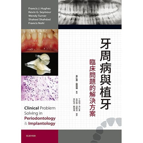 [愛思唯爾~書本熊] 牙周病與植牙：臨床問題的解決方案／Francis J. Hughes&lt;書本熊書屋&gt;