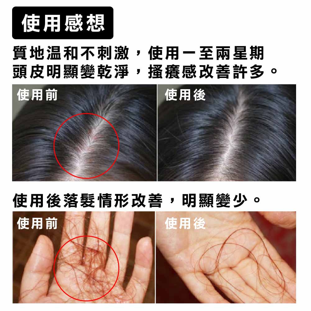 韓國人 開立雲端發票 Evas Valmona 草本養護洗髮精潤髮乳480ml 頭皮養護強健髮根防落髮 蝦皮購物