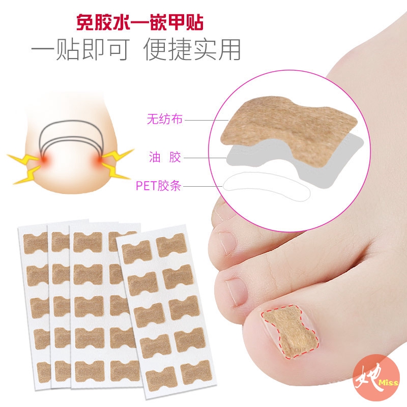 Miss她 正甲膠條貼防卷甲免膠水腳趾嵌甲矯正器甲貼片拉修指甲專用 蝦皮購物