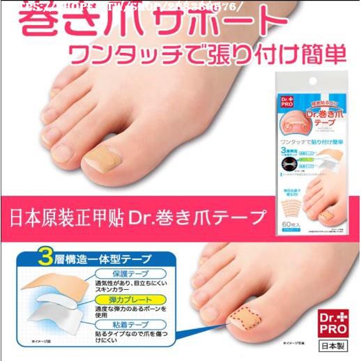 趾甲貼片腳趾矯正器指甲貼指甲矯正貼日本正甲貼甲溝嵌甲矯正器炎腳溝腳趾趾甲貼片指甲長肉裡神器套裝rita 蝦皮購物