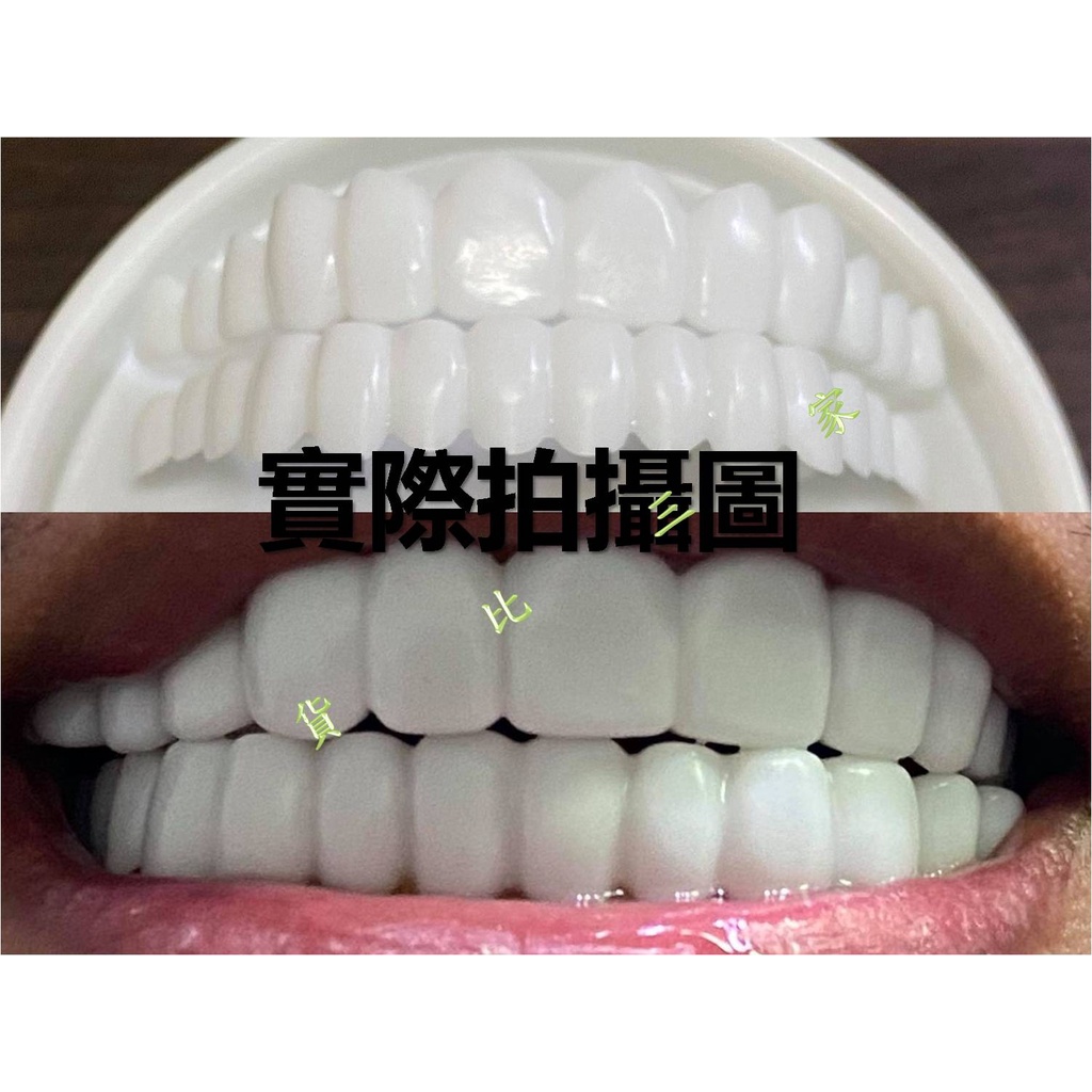 tru smile 第五代仿真牙套 自製假牙 假牙套 牙洞修 補牙洞 可脫卸 美容牙套 美齒牙套 假牙片 假牙貼 口腔