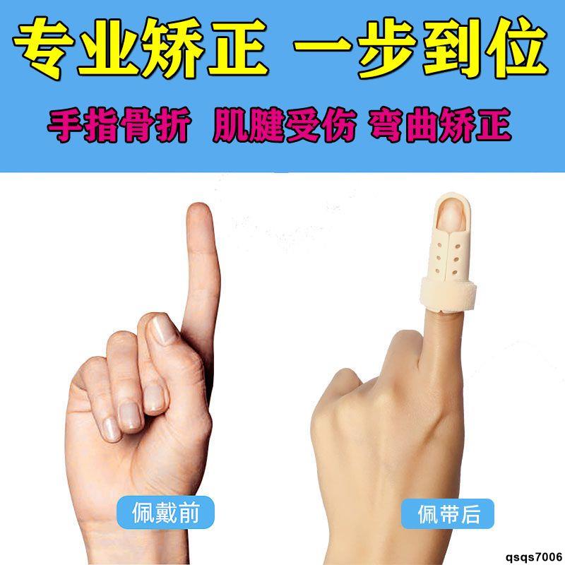 【熱銷款】手指矯正器手指固定器手指骨折夾板變直指尖保護伸直肌腱斷裂彎曲
