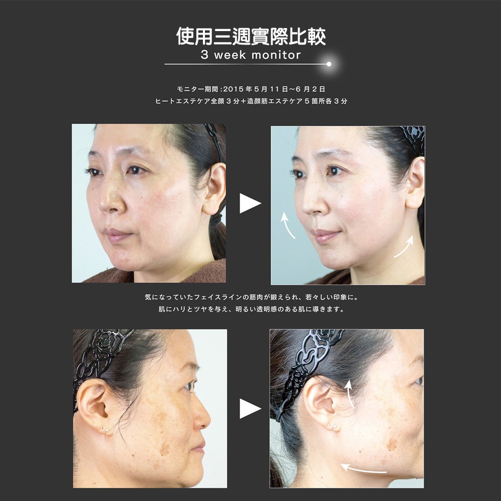Couleur Labo Zogankin Hyper 第二代提拉緊緻美容儀 緊實小顏拉皮機cl Sml008 蝦皮購物