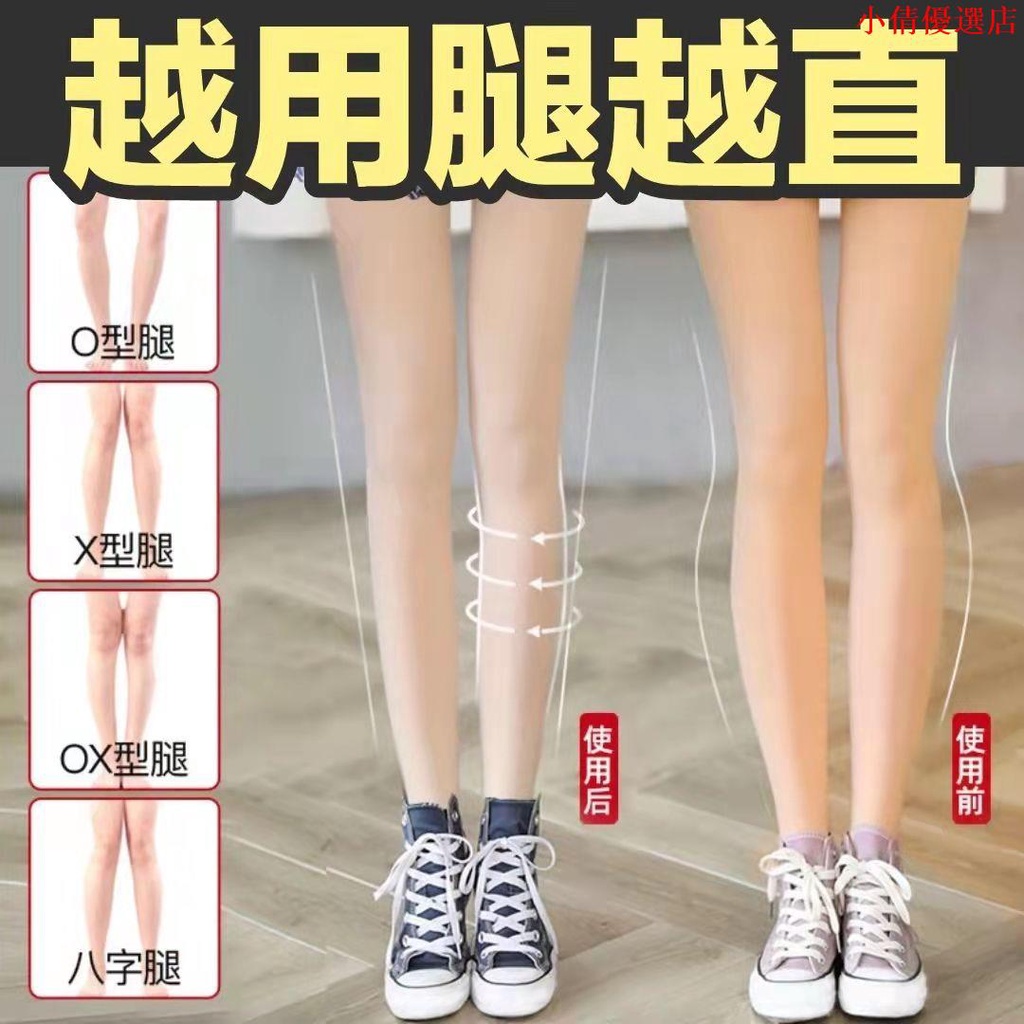 【腿型矯正】XO型腿—張力失衡 — 樞適物理治療 Central X Physical Therapy