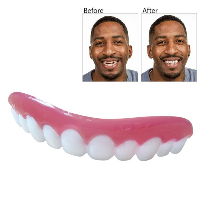 美白牙貼 smile veneers 矽膠模擬上排假牙套 矽膠仿真牙齒牙套