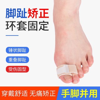 柒柒家居熱銷新款現貨成人兒童錘狀趾矯正器爪狀腳趾彎曲重疊指固定綁帶手指骨折矯正帶