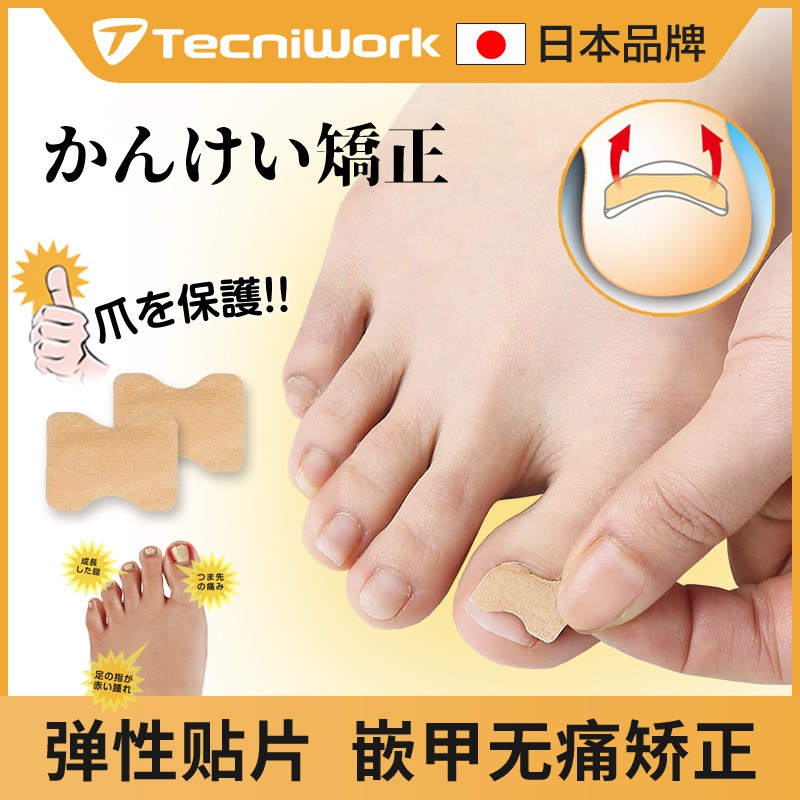 指甲矯正器日本 便宜商品推薦與商品比價 21年10月 飛比價格