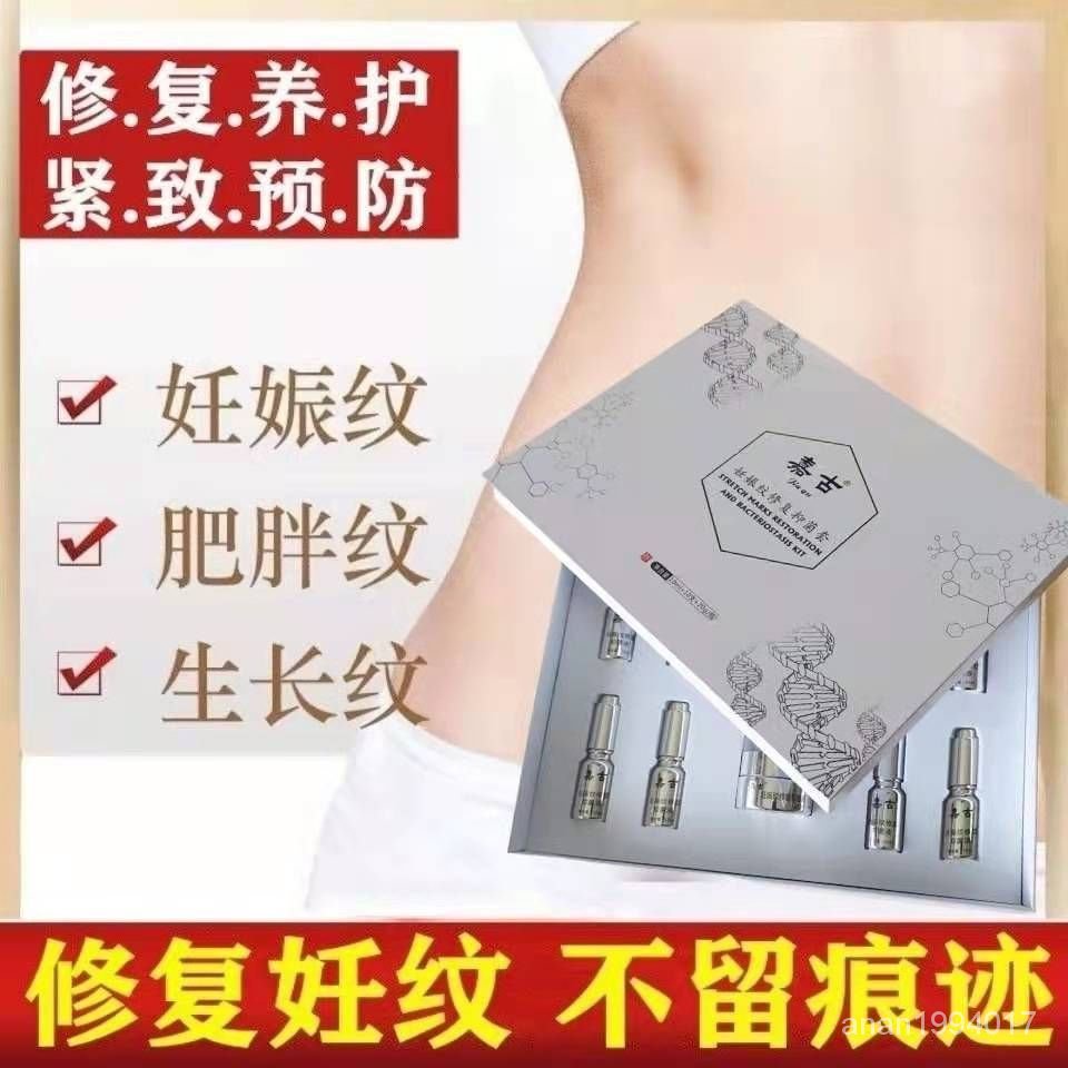 肥胖紋妊娠 Ptt Dcard討論與高評價網拍商品 2021年11月 飛比價格