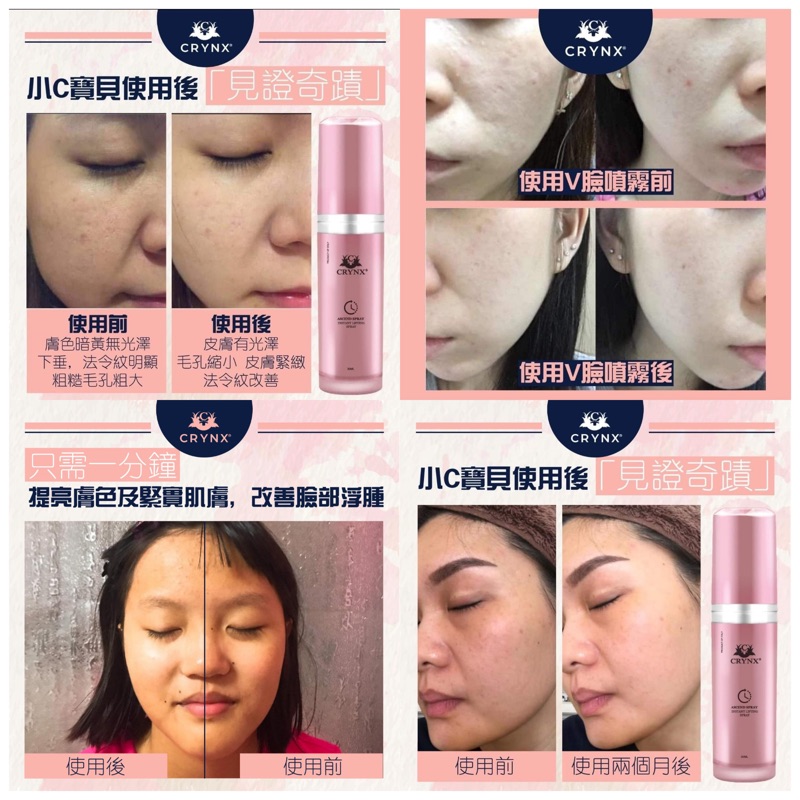 Sonia Usa Korea 嚴選正品快速出貨可孋詩v臉噴霧 蝦皮購物