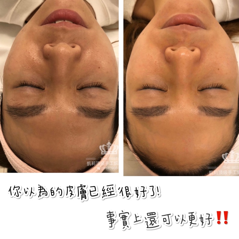 八倍水渦漩淨膚保濕保養護膚鎖水拉提亮白縮毛孔除粉刺 蝦皮購物