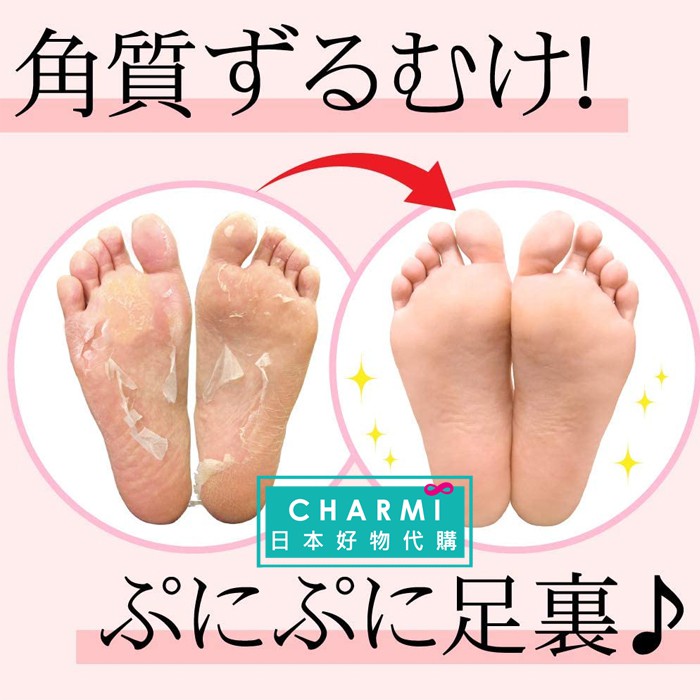 查米 現貨日本製perorin 足部去角質足膜一盒2雙入玫瑰 薰衣草美腳美足必備溫和去角質 蝦皮購物