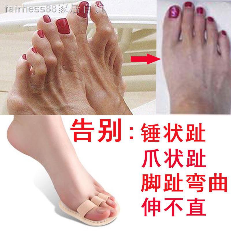 限時下殺腳趾矯正器 成人重疊彎曲錘狀小腳趾矯正器爪狀趾拇指外翻大腳骨分趾器日夜用 蝦皮購物