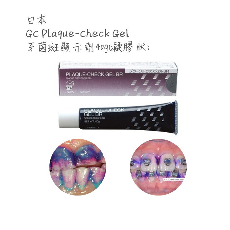 🔥送塗抹棒🔥★日本進口★GC 牙菌斑顯示劑(凝膠狀)★三種色階★清楚顯示新舊牙菌斑