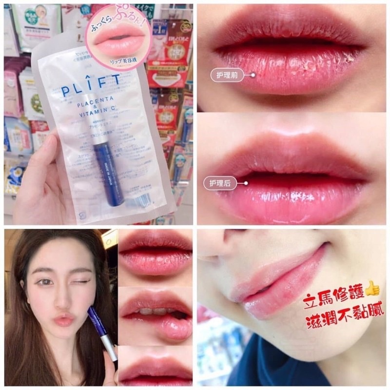 同梱不可】 PLIFT VPリップ9個セット i9tmg.com.br