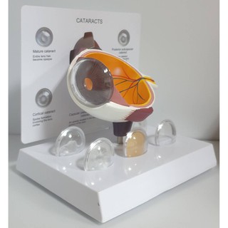[臺灣現貨 快速出貨 開立發票]眼睛模型 白內障眼睛模型 眼球模型 眼科教學模型 眼科解剖模型 模型