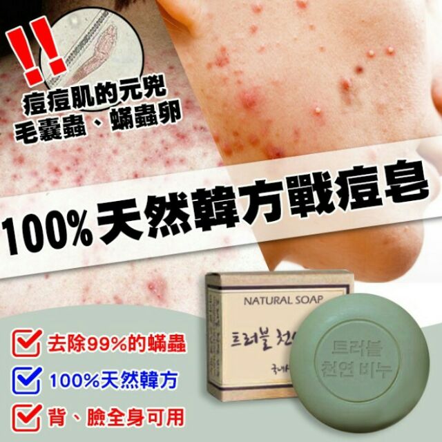 🔛現貨★韓國正貨★【100%天然韓方戰痘袪蟎皂100G】