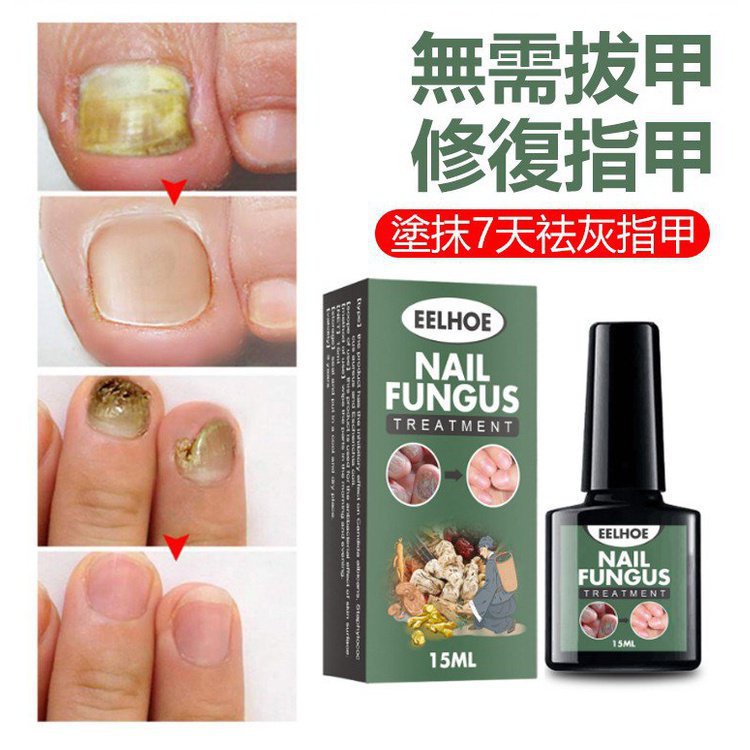 腐甲 優惠推薦 22年7月 蝦皮購物台灣