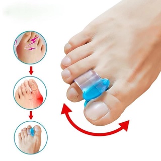 1對 拇指外翻分趾器 腳趾矯正器 女士大腳骨姆趾頭 可以穿鞋糾正矯形