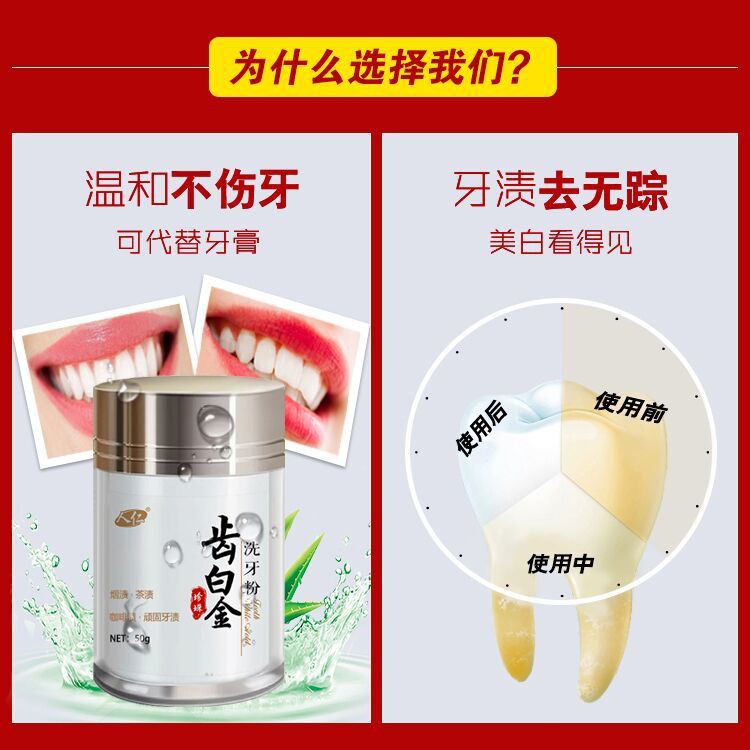 亮白牙齒美白神器 齒白金洗牙粉美白牙齒神器去黃牙去煙漬牙去牙結石去口臭廠家正品 蝦皮購物