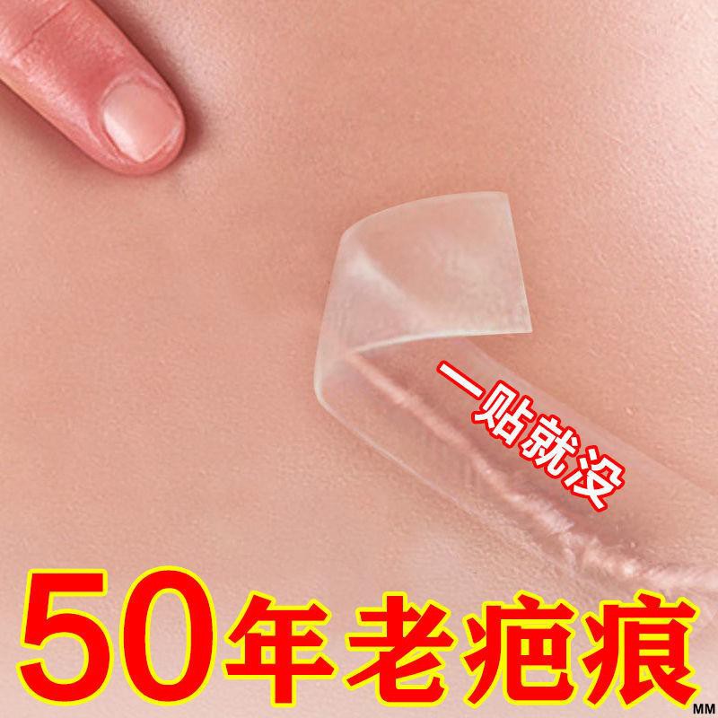 推薦款 傷疤貼祛疤再生貼燙傷淡化疤痕人工皮再生貼剖腹產手術傷疤痘印 蝦皮購物