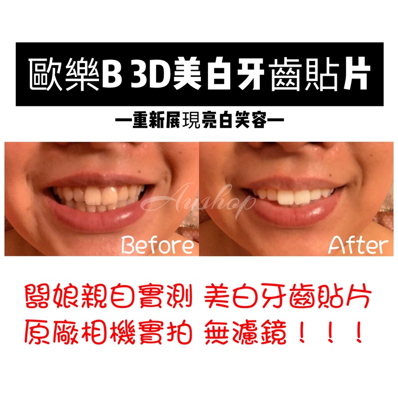 Au Shop 現貨歐樂b 3d美白牙齒貼片14組 Oralb 3d White Strips 蝦皮購物